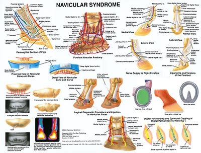 Navicular Syndrome Chart-www.hoofprints.com