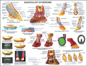 Navicular Syndrome Chart